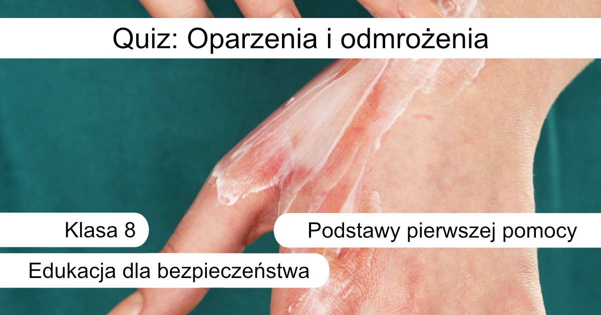 Quiz: Oparzenia i odmrożenia