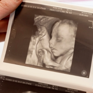 Quizy: Rozmnażanie i rozwój człowieka