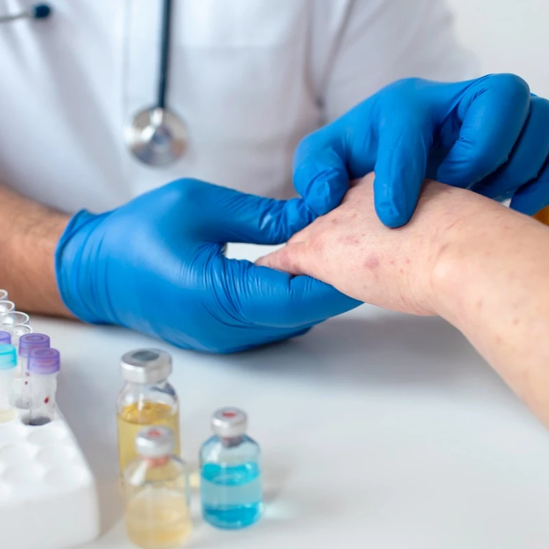 Quiz: Higiena i choroby skóry (10 pytań)